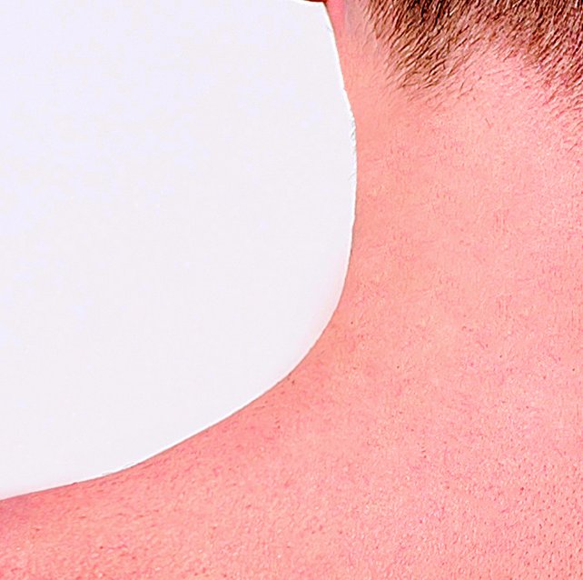 Formu Clear Skin Tag Patch - Sortiment mit 30 Stück - Warzenpflaster