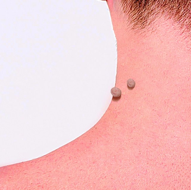 Formu Clear Skin Tag Patch - Sortiment mit 30 Stück - Warzenpflaster